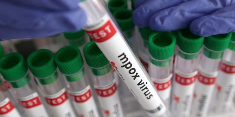 Health advocates press Cepheid for cheaper mpox tests